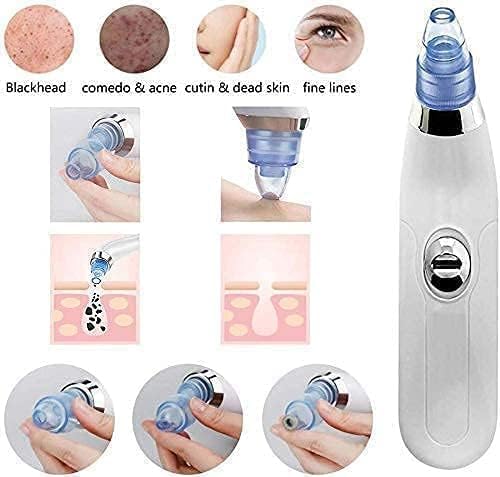 Blackhead Whitehead Extractor Remover