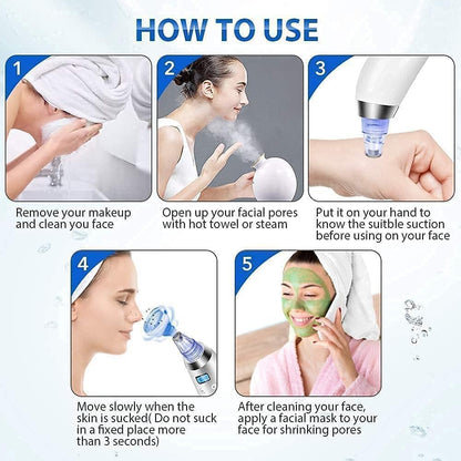 Blackhead Whitehead Extractor Remover