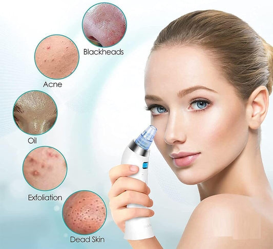 Blackhead Whitehead Extractor Remover